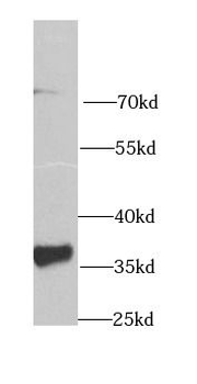GAS2 Rabbit Polyclonal Antibody