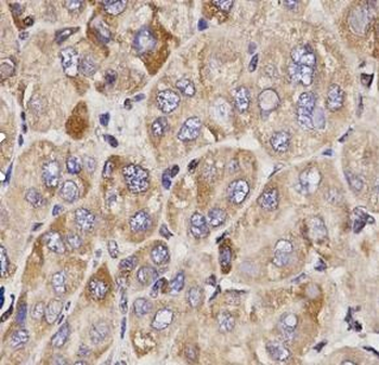GAS2 Rabbit Polyclonal Antibody