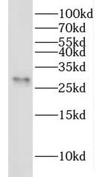 YEATS4 Rabbit Polyclonal Antibody