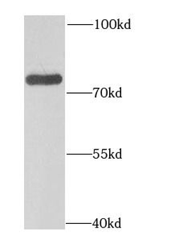 GAS6 Rabbit Polyclonal Antibody