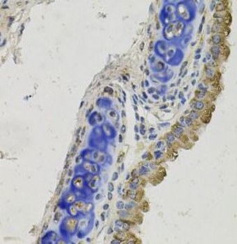 GAS6 Rabbit Polyclonal Antibody