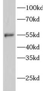 GATA1 Rabbit Polyclonal Antibody