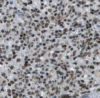 GATA1 Rabbit Polyclonal Antibody