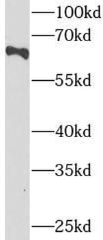 GBA1 Rabbit Polyclonal Antibody