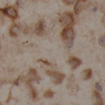 GBA1 Rabbit Polyclonal Antibody