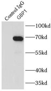 GBP1 Rabbit Polyclonal Antibody
