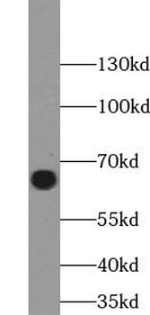 GBP1 Rabbit Polyclonal Antibody