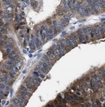 GBP1 Rabbit Polyclonal Antibody