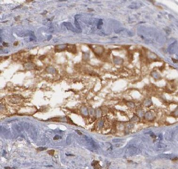 NR6A1 Rabbit Polyclonal Antibody