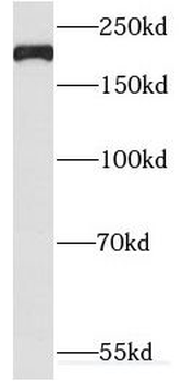 TUBGCP6 Rabbit Polyclonal Antibody