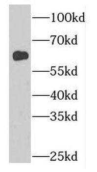GDPD2 Rabbit Polyclonal Antibody