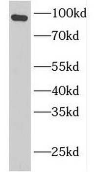 GSN Rabbit Polyclonal Antibody