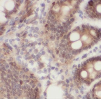 GSN Rabbit Polyclonal Antibody