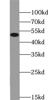 GFAP Rabbit Polyclonal Antibody