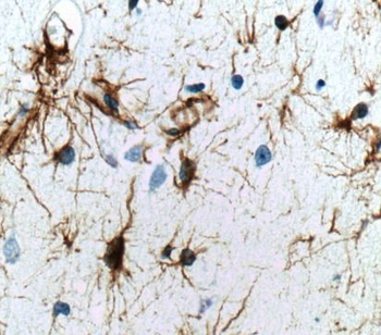 GFAP Rabbit Polyclonal Antibody