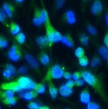 GFAP Rabbit Polyclonal Antibody