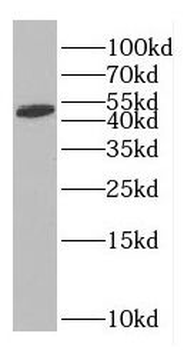 GFAP Rabbit Polyclonal Antibody