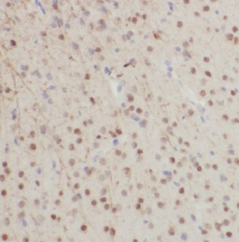 GFAP Rabbit Polyclonal Antibody