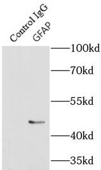 GFAP Mouse Monoclonal Antibody