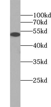 GFAP Mouse Monoclonal Antibody