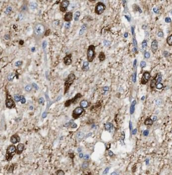 GFAP Mouse Monoclonal Antibody