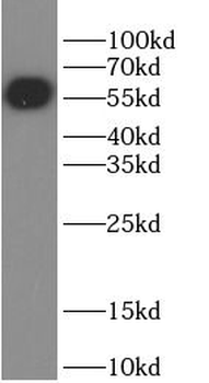 GFP tag Mouse Monoclonal Antibody