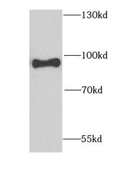 GFPT1 Rabbit Polyclonal Antibody