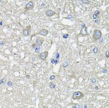 GFPT1 Rabbit Polyclonal Antibody