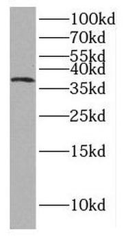 GFRA2 Rabbit Polyclonal Antibody