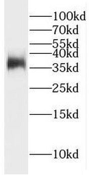 GFRA2 Rabbit Polyclonal Antibody