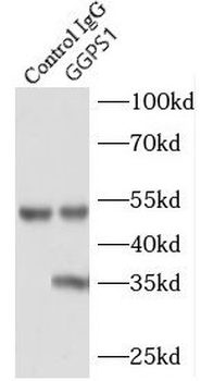 GGPS1 Rabbit Polyclonal Antibody