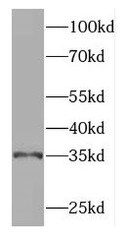 GGPS1 Rabbit Polyclonal Antibody