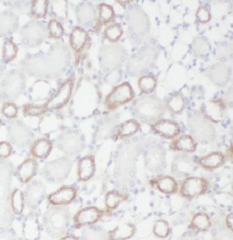 GGPS1 Rabbit Polyclonal Antibody