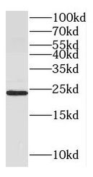 GH2 Rabbit Polyclonal Antibody
