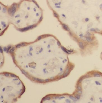 GH2 Rabbit Polyclonal Antibody
