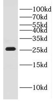 GHITM Rabbit Polyclonal Antibody