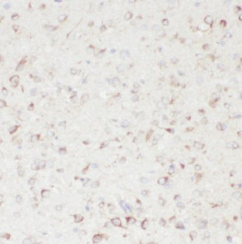 GHITM Rabbit Polyclonal Antibody