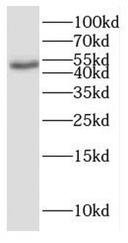 GHRHR Rabbit Polyclonal Antibody