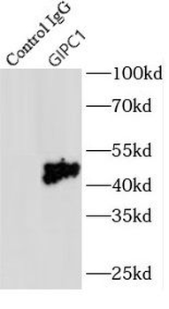GIPC1 Rabbit Polyclonal Antibody