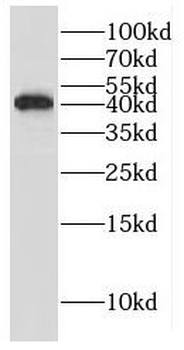 GIPC1 Rabbit Polyclonal Antibody