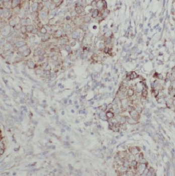 GIPC1 Rabbit Polyclonal Antibody