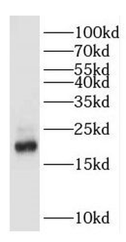 GKN2 Rabbit Polyclonal Antibody