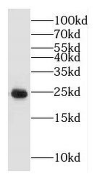 GLIPR1L1 Rabbit Polyclonal Antibody