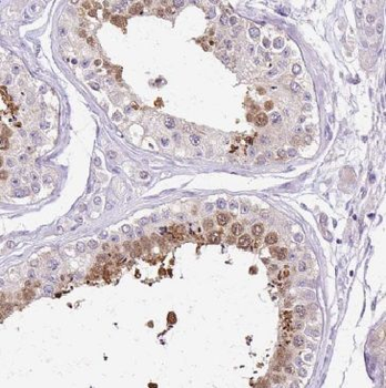 GLIPR1L1 Rabbit Polyclonal Antibody