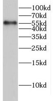 GLRB Rabbit Polyclonal Antibody