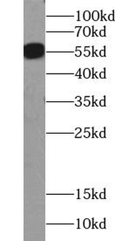 SLC2A4 Rabbit Polyclonal Antibody