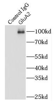 GRIA2 Rabbit Polyclonal Antibody