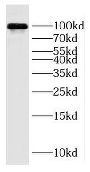GRIA2 Rabbit Polyclonal Antibody