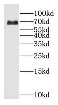 GPC3 Rabbit Polyclonal Antibody
