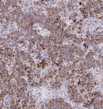 GPC3 Rabbit Polyclonal Antibody